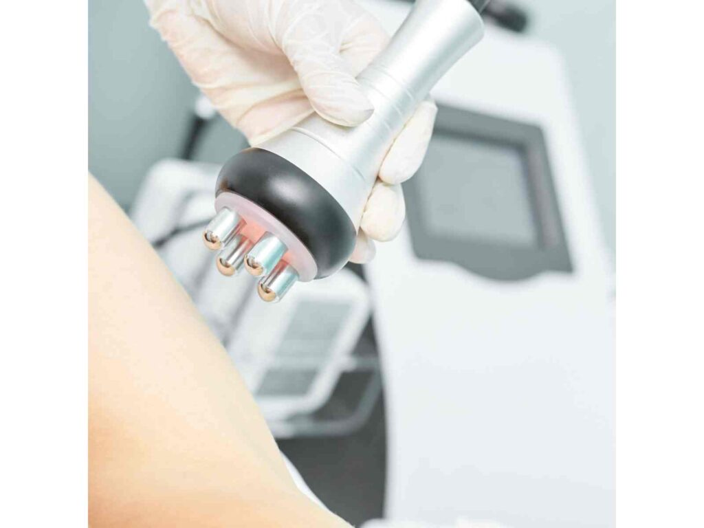 RF Ultrasound Cavitation 